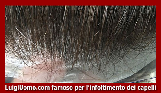 11-Protesi-di-capelli-per-uomo-donna-per-uomo-donna-vip-in-lace-skin-poliuretano-pu-monofilamento-silicone-impianto-luigiuomo-